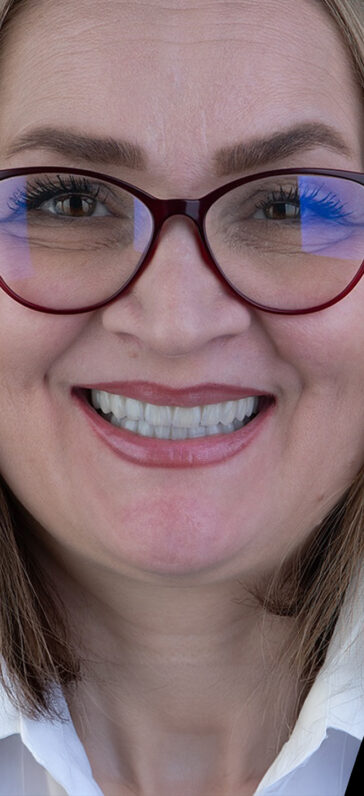 dental-implants-in-turkey-1