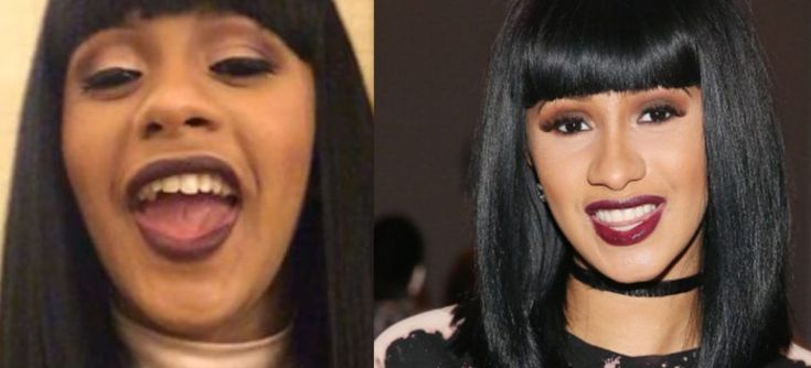 cardi b teeth