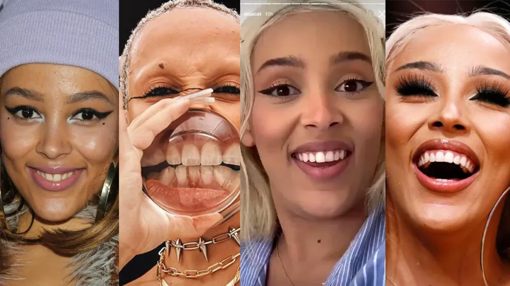 doja cat teeth