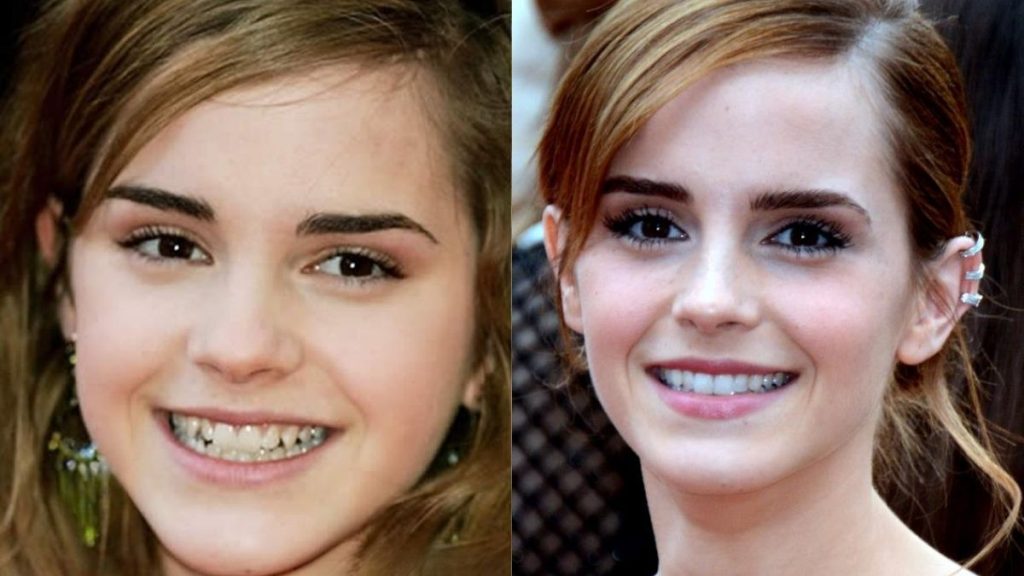 celebrities emma watson