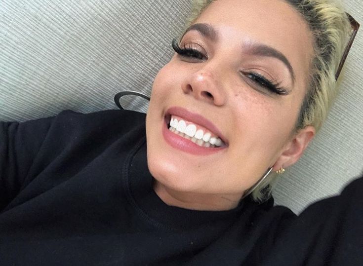 halsey teeth