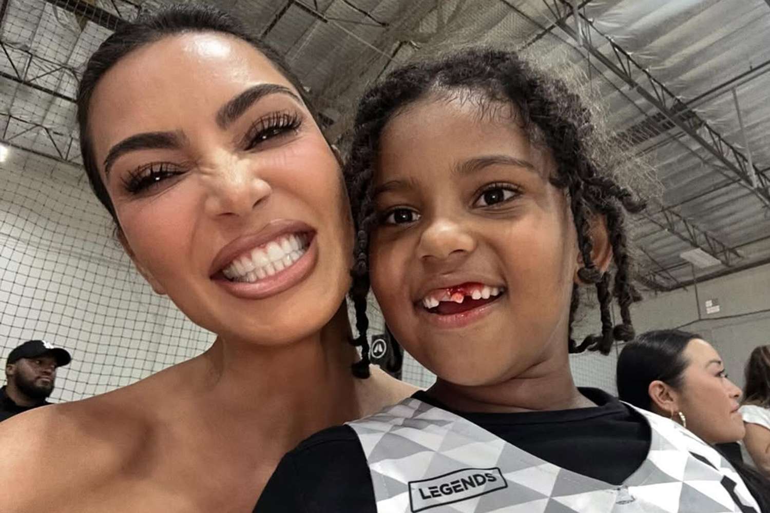 kim kardashian teeth