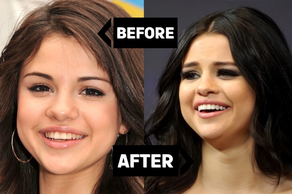 selena gomez teeth