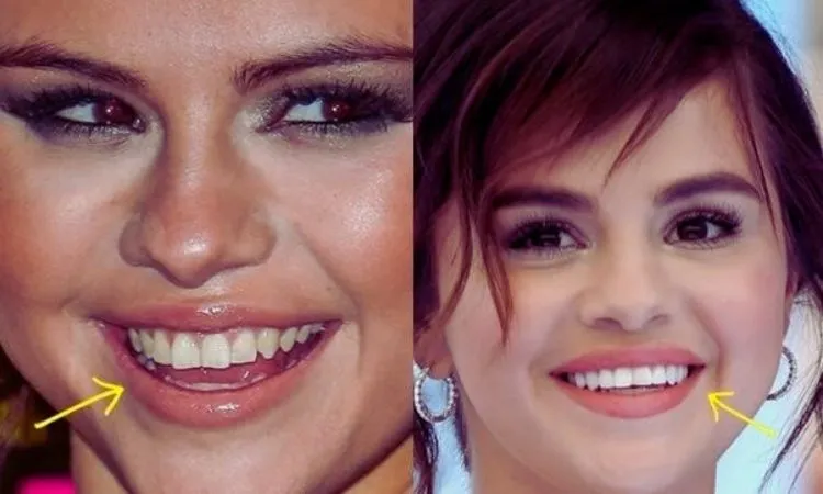 selena gomez teeth