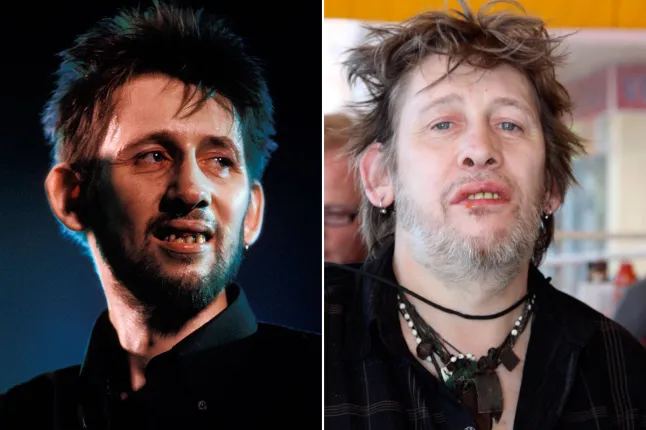 shane macgowan teeth