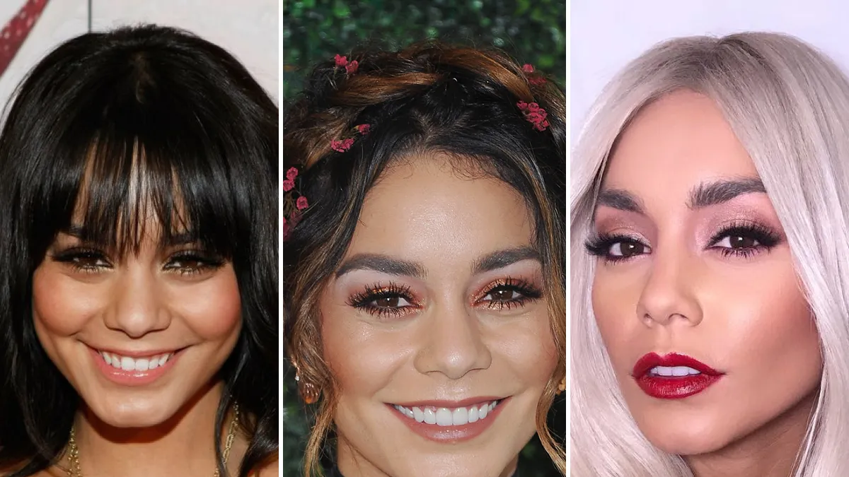 vanessa hudgens teeth